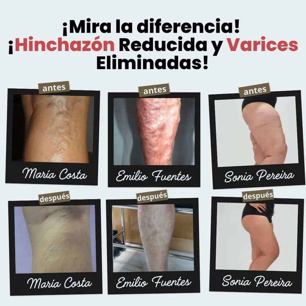 (Paga 1 y Recibe 1 Gratis) Calcetines de Acupresión Antivarices – Talla Universal (Compatible con cualquier tamaño).