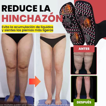 (Paga 1 y Recibe 1 Gratis) Calcetines de Acupresión Antivarices – Talla Universal (Compatible con cualquier tamaño).