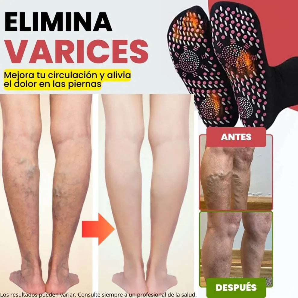 (Paga 1 y Recibe 1 Gratis) Calcetines de Acupresión Antivarices – Talla Universal (Compatible con cualquier tamaño).