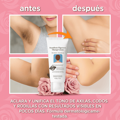 🌸 BellaLuz 🌸 Crema Blanqueadora Hipoalergénica – Despídete de las manchas oscuras de tu piel antes de Navidad.